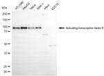 ATF6 Antibody in Western Blot (WB)