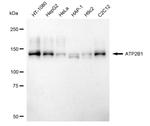 PMCA1 ATPase Antibody in Western Blot (WB)