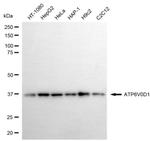 ATP6V0D1 Recombinant Rabbit Monoclonal Antibody (24GB6855)