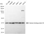 CAB39 Antibody in Western Blot (WB)