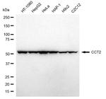 TCP-1 beta Antibody in Western Blot (WB)