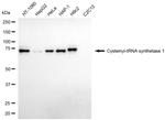 CARS Antibody in Western Blot (WB)