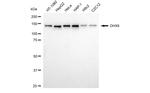 DHX9 Antibody in Western Blot (WB)