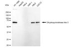 DPYSL3 Antibody in Western Blot (WB)