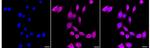 Endothelin B Receptor Recombinant Rabbit Monoclonal Antibody (24GB3375)