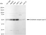 Endothelin B Receptor Antibody in Western Blot (WB)