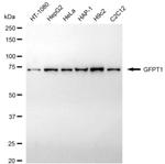 GFPT1 Antibody in Western Blot (WB)