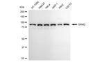 GluR6 Antibody in Western Blot (WB)