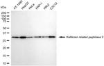 Kallikrein 2 Antibody in Western Blot (WB)