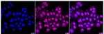 MSP Recombinant Rabbit Monoclonal Antibody (24GB635)