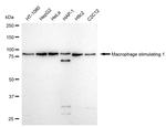 MSP Antibody in Western Blot (WB)