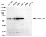 MAdCAM-1 Antibody in Western Blot (WB)