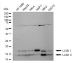 LC3B Recombinant Rabbit Monoclonal Antibody (24GB4955)