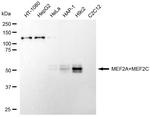 MEF2A/MEF2C Antibody in Western Blot (WB)