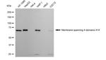 MS4A14 Antibody in Western Blot (WB)