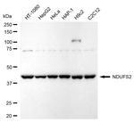 NDUFS2 Antibody in Western Blot (WB)