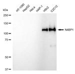 N4BP1 Antibody in Western Blot (WB)