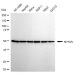 NPY5R Antibody in Western Blot (WB)