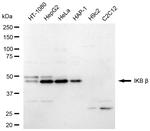 IkB beta Antibody in Western Blot (WB)