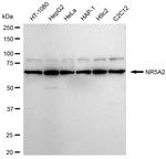 NR5A2 Antibody in Western Blot (WB)