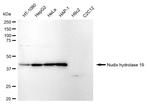 NUDT19 Antibody in Western Blot (WB)