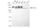 Palladin Antibody in Western Blot (WB)