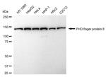 PHF8 Antibody in Western Blot (WB)