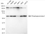 PGM1 Antibody in Western Blot (WB)