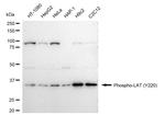 Phospho-LAT (Tyr220) Antibody in Western Blot (WB)