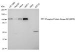 Phospho-PRKD2 (Ser876) Antibody in Western Blot (WB)