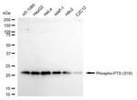 Phospho-PTS (Ser19) Antibody in Western Blot (WB)