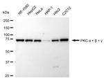 PKC alpha/beta/gamma Antibody in Western Blot (WB)