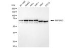 PPP2R5D Antibody in Western Blot (WB)