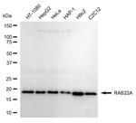 RAB22A Antibody in Western Blot (WB)