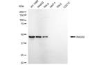 RAD52 Antibody in Western Blot (WB)