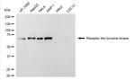 RYK Antibody in Western Blot (WB)