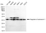 RCAN1 Antibody in Western Blot (WB)