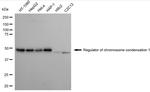 RCC1 Antibody in Western Blot (WB)