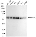 RGS6 Antibody in Western Blot (WB)