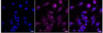 ROR2 Recombinant Rabbit Monoclonal Antibody (24GB1065)