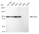 ROR2 Antibody in Western Blot (WB)