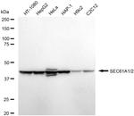 SEC61alpha Antibody in Western Blot (WB)