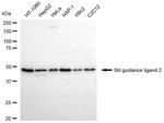 SLIT2 Antibody in Western Blot (WB)