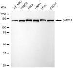 SMC1 Antibody in Western Blot (WB)