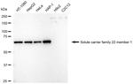 SLC22A1 Antibody in Western Blot (WB)