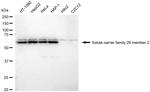 ENT2 Antibody in Western Blot (WB)
