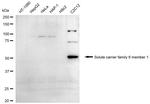 SLC6A1 Recombinant Rabbit Monoclonal Antibody (24GB2390)