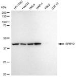 SPRY2 Antibody in Western Blot (WB)