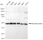 SRSF6 Antibody in Western Blot (WB)