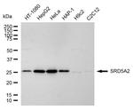 SRD5A2 Antibody in Western Blot (WB)